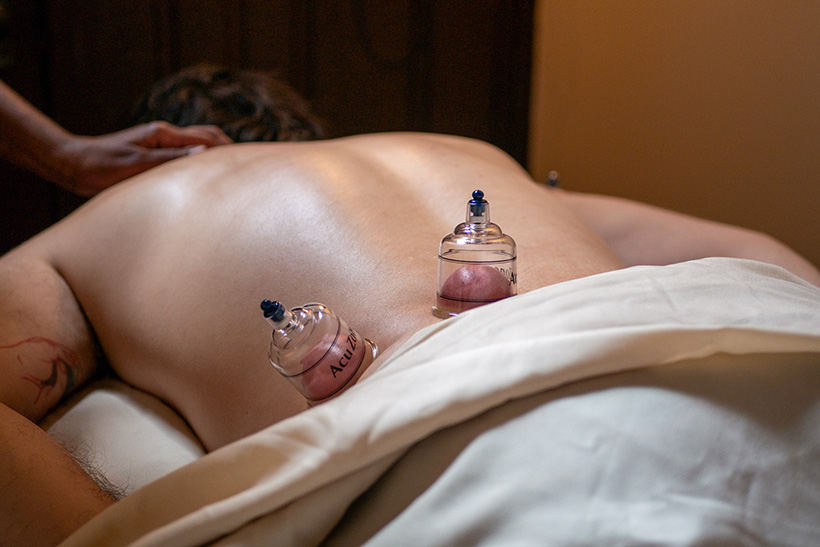 Cupping therapy cups placed on the back to support pain relief, circulation, and muscle recovery