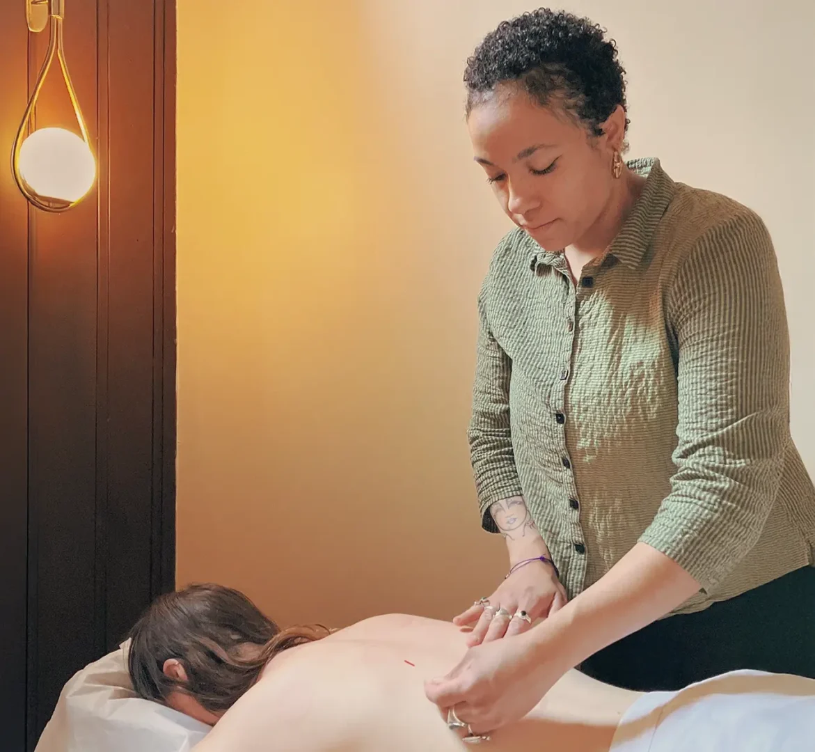 Acupuncture treatment at Sanctuary Health in Chicago focusing on circulation and pain relief
